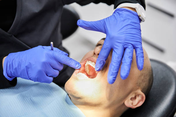 Best Emergency Wisdom Teeth Removal in Fayetteville, TN